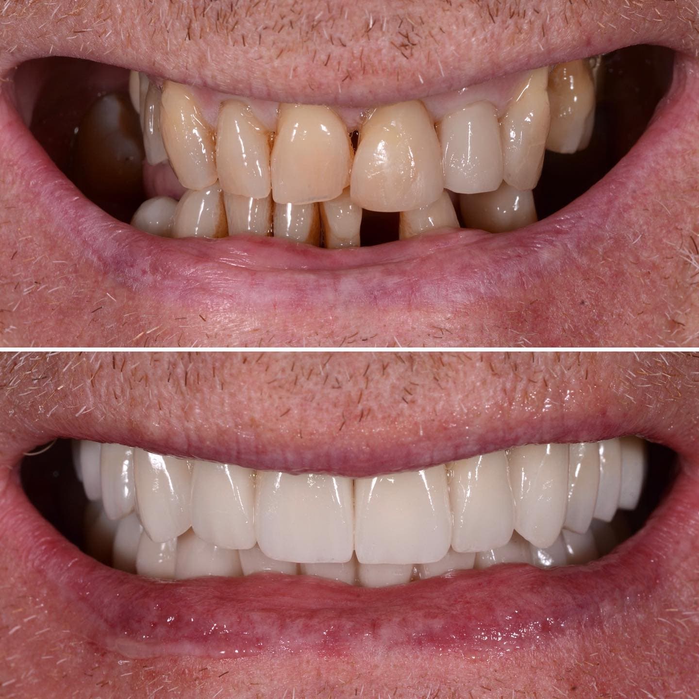 Before and after: smile design