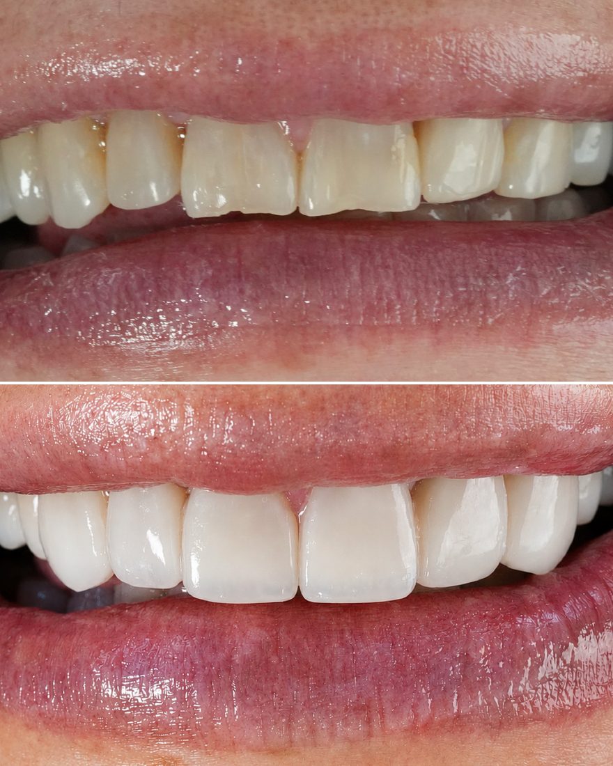 Oral rehabilitation