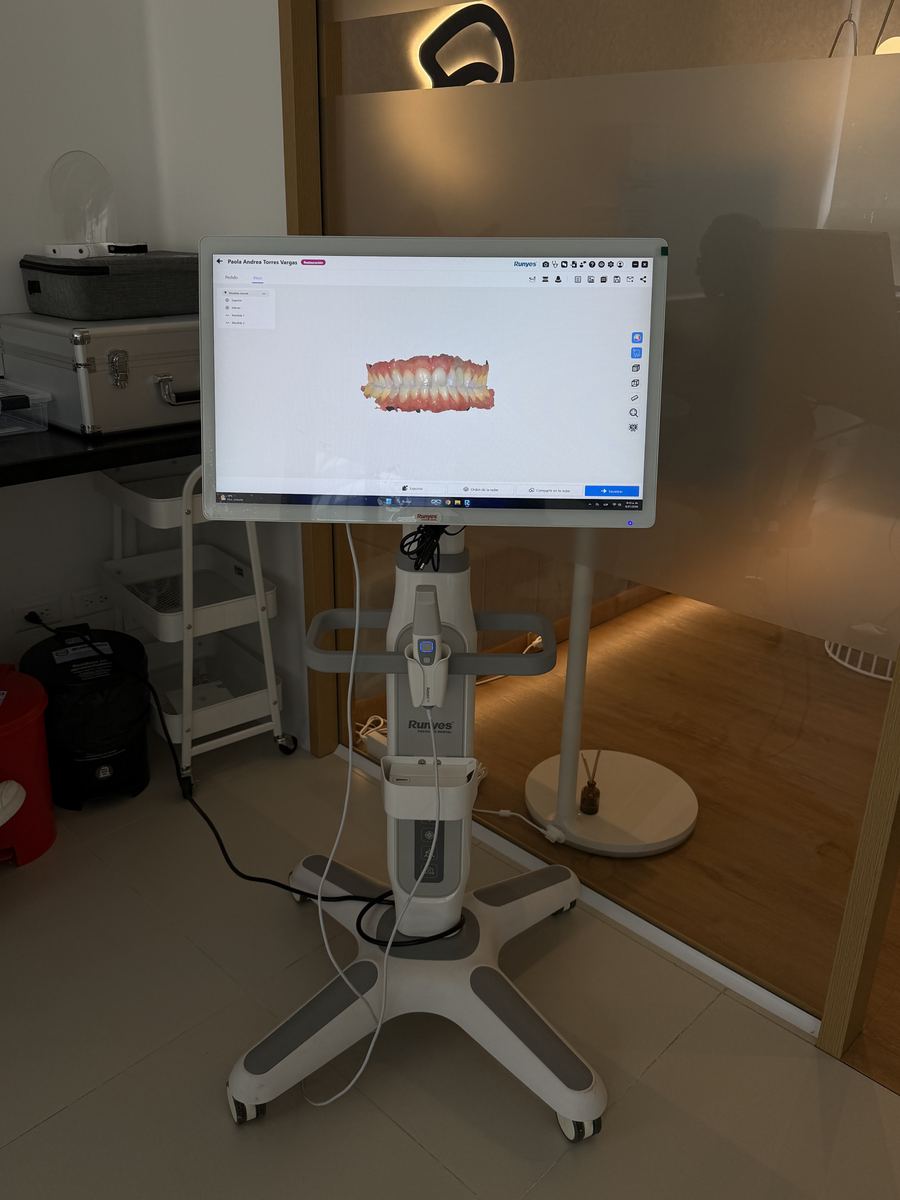 Digital scanner with a 3D model on screen